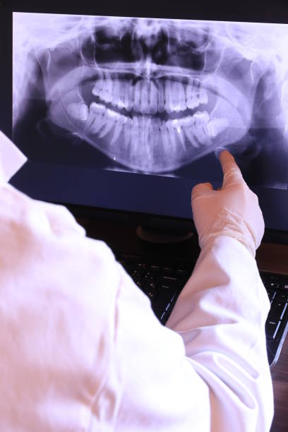 Best Emergency Denture Repair in Bernardsville, NJ